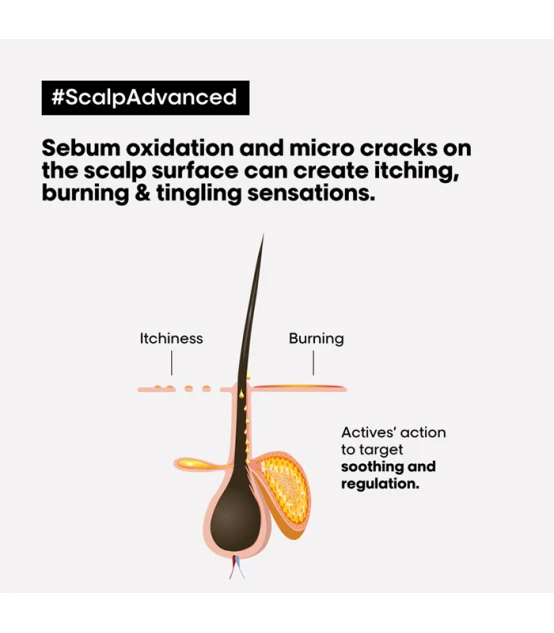 L'Oréal Professionnel Scalp Advanced Treatment Anti-Discomfort 200 ...