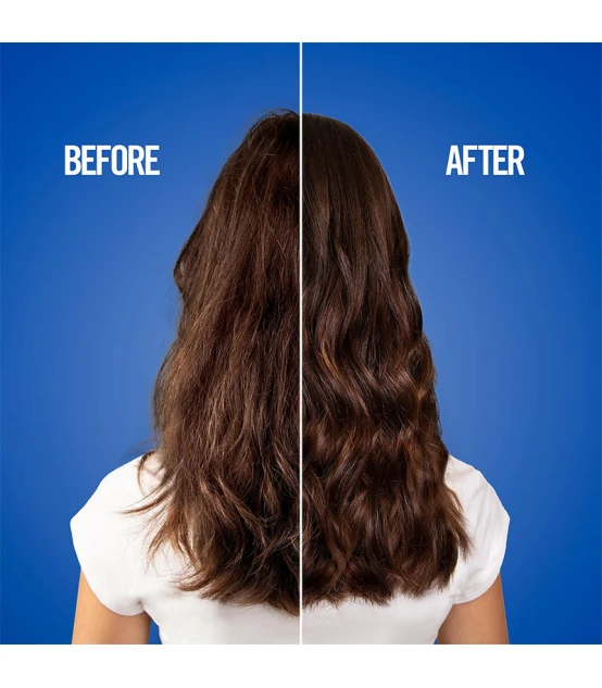 Revlon Professional Uniq One All In One Hair Treatment Limited Edit...