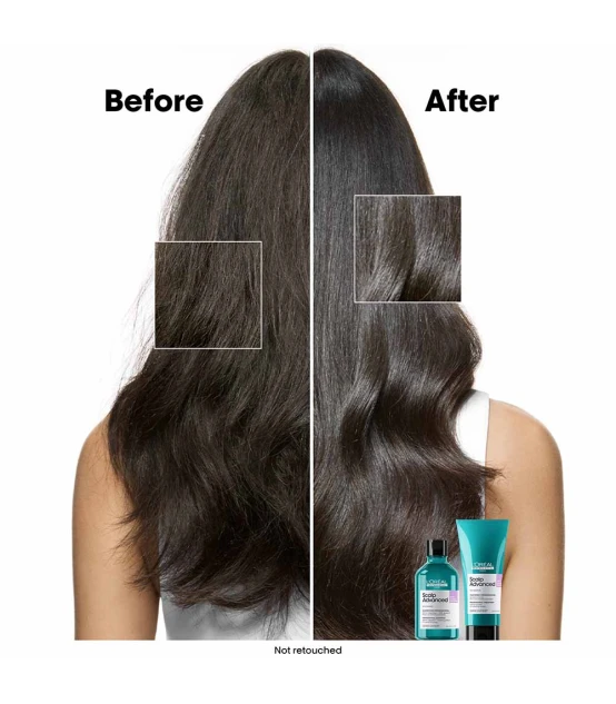L'Oréal Professionnel Série Expert Scalp Advanced Shampoo Anti-Inco...