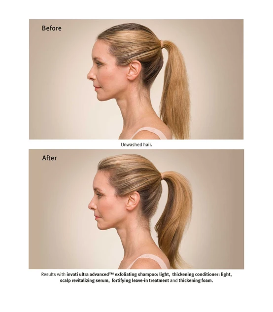 Aveda Invati Ultra Advanced Light System  | Celini.be