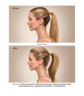 Aveda Invati Ultra Advanced Light System  | Celini.be