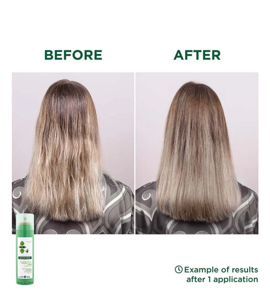 Klorane Shampooing Sec Séboréducteur à l'Ortie 150ml  | Celini.be