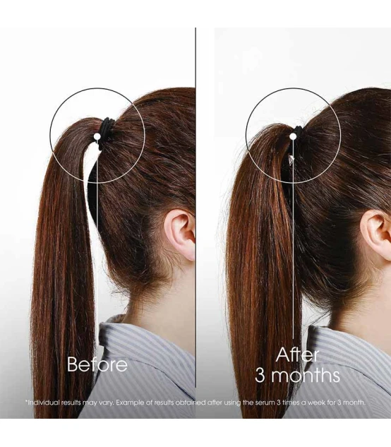 Klorane Antichute Traitement Fortifiant Intense à la Quinine 100ml ...