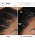 FutureIQ™ Serum Biomimétique Longévité Capillaire 90ml